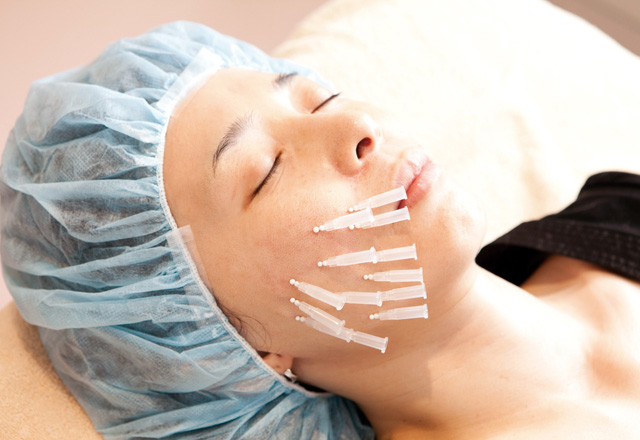 大名町スキンクリニック (メディカルビューティ / 福井レーザー)「ウルトラVリフト®(リードファインリフト)」